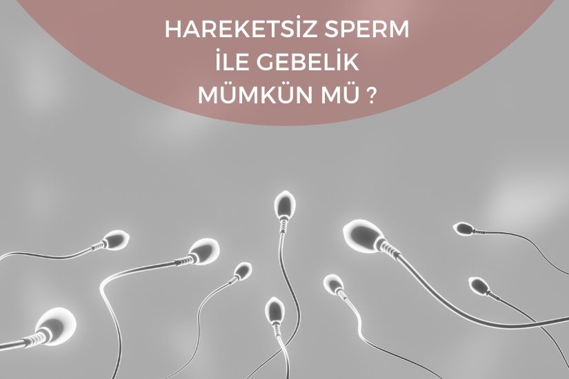 Hareketsiz sperm ile gebelik mümkün mü