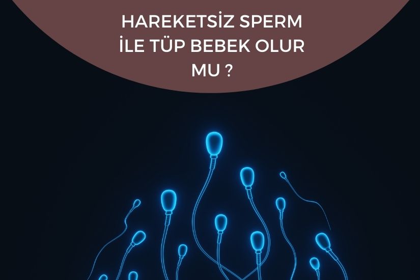 Hareketsiz sperm ile tüp bebek olur mu