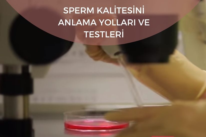 Sperm Kalitesini Anlama Yolları ve Testleri